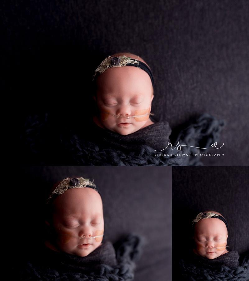 NICU graduate - a 25 week preemie has her newborn photo session in Cedar Rapids