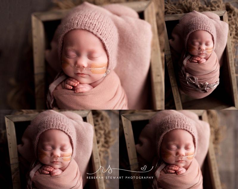 NICU graduate - a 25 week preemie has her newborn photo session in Cedar Rapids 