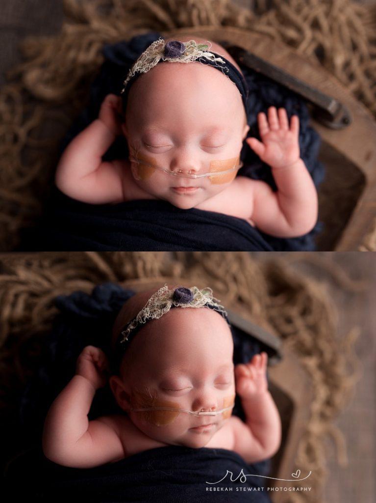 NICU graduate - a 25 week preemie has her newborn photo session in Cedar Rapids 